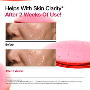 Anua Niacinamide 10% + TXA 4% Sérum 30ml